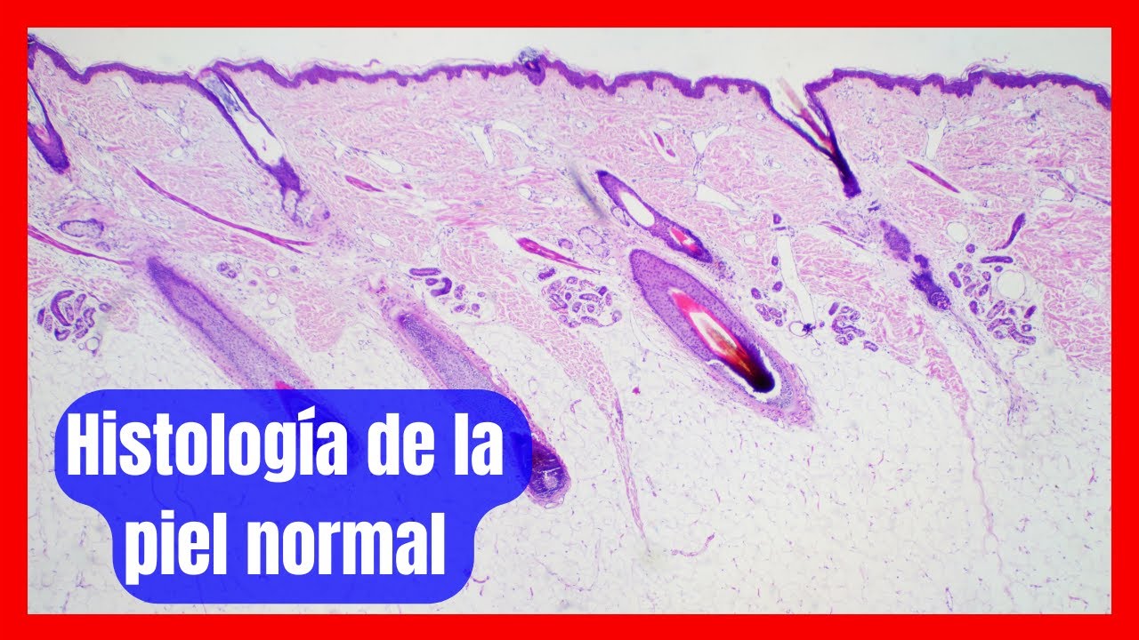 Dermatopatolog&iacute;a: histolog&iacute;a de la piel normal