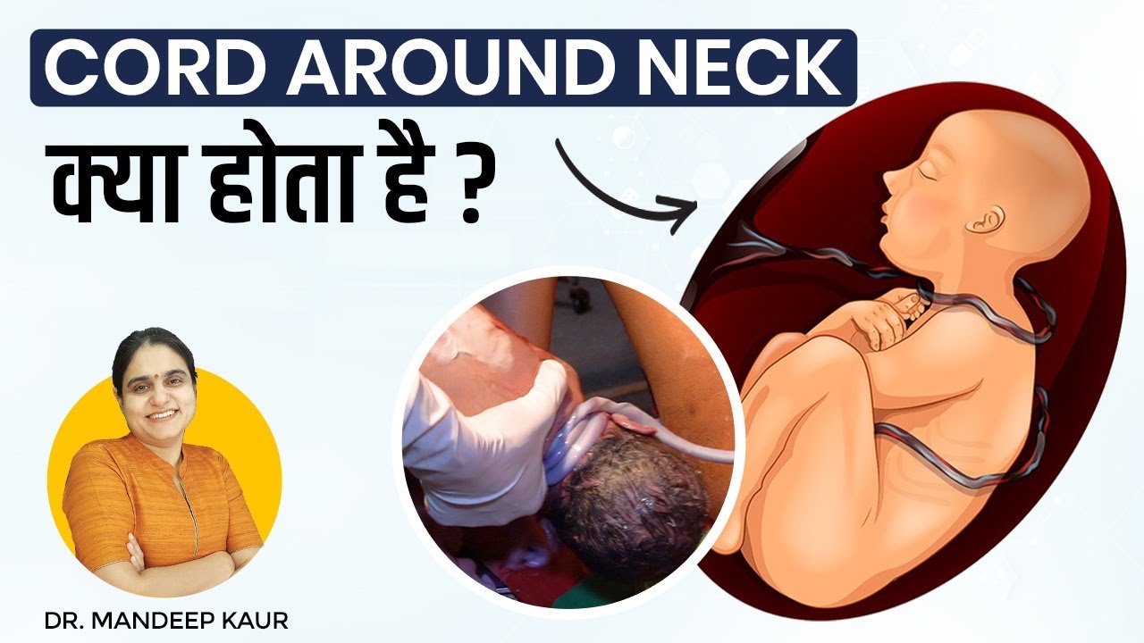 Cord Around Neck, meaning in Hindi, in Ultrasound, Types, how Remove Single, Loop Cord, Boy or girl.