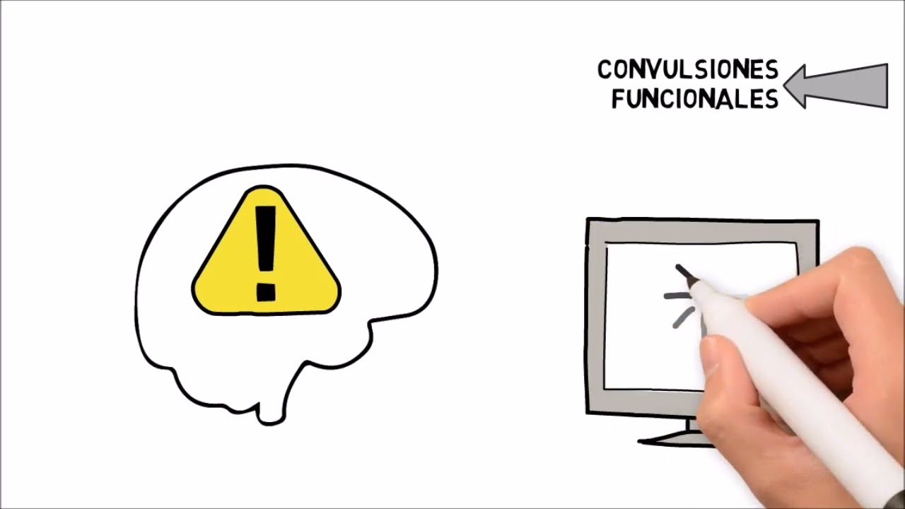 Trastornos Neurológicos Funcionales