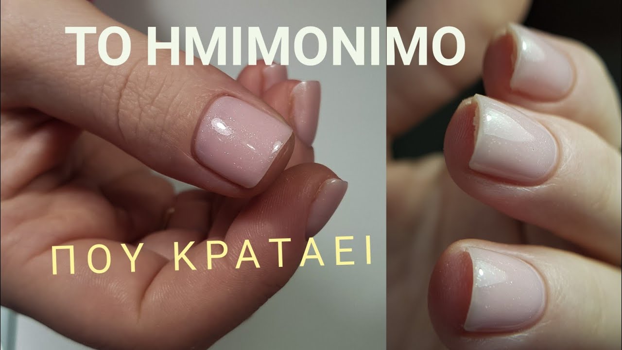 Ημιμονιμο μετα απο 2 μηνες/ λιμαρουμε σωστα το ελευθερο ακρο/ φρεζα καρβιδιου/ φλογα τορναντο