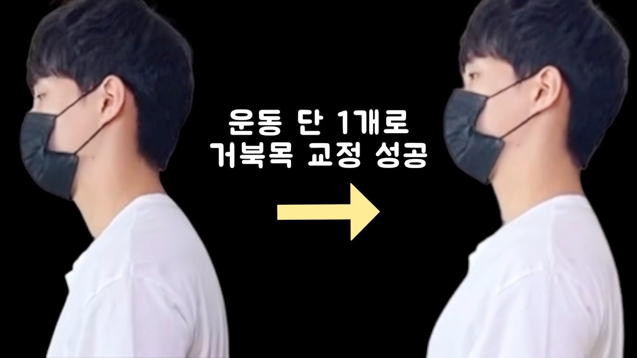 거북목, 굽은등 교정 방법‼️ 목 당기기, 가슴 펴기가 '아닙니다'❌