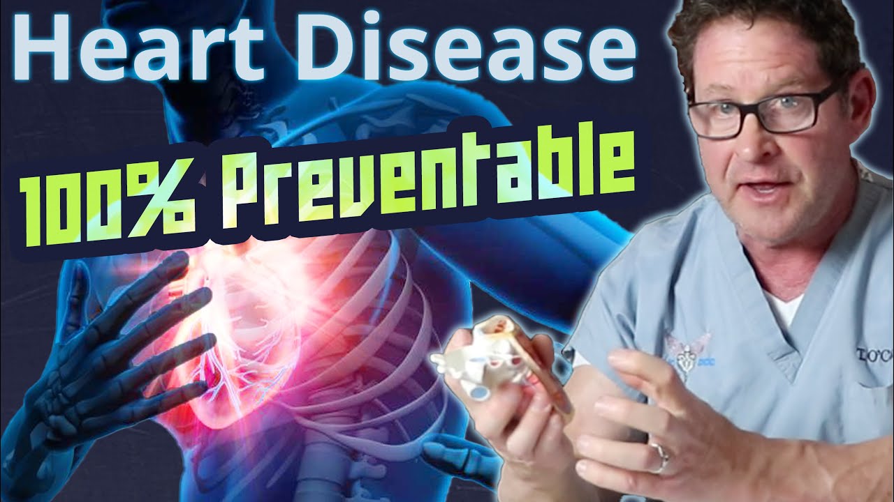 Heart Disease is 100% Preventable!