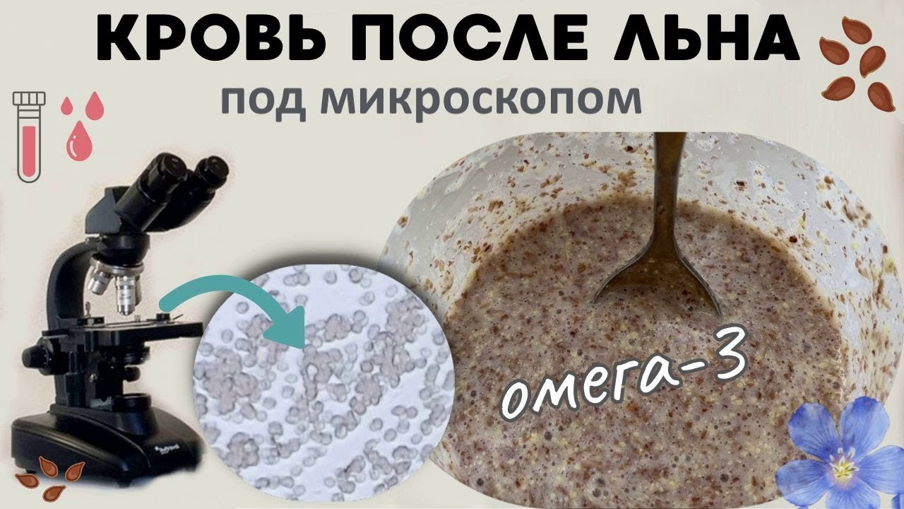 Кровь течет, как быстрая река!  ...после льна