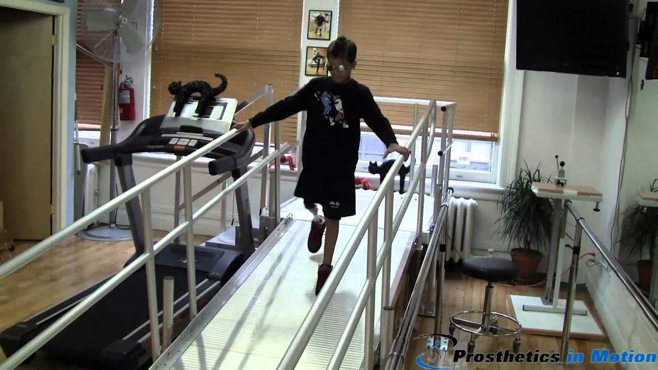 Young above the knee ( AK ) child demonstrates the Ossur Total Knee 2000 with flex foot