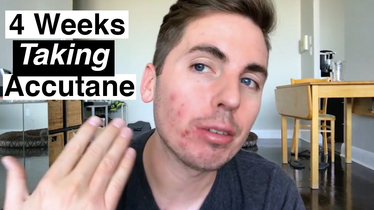 4 Weeks on Accutane