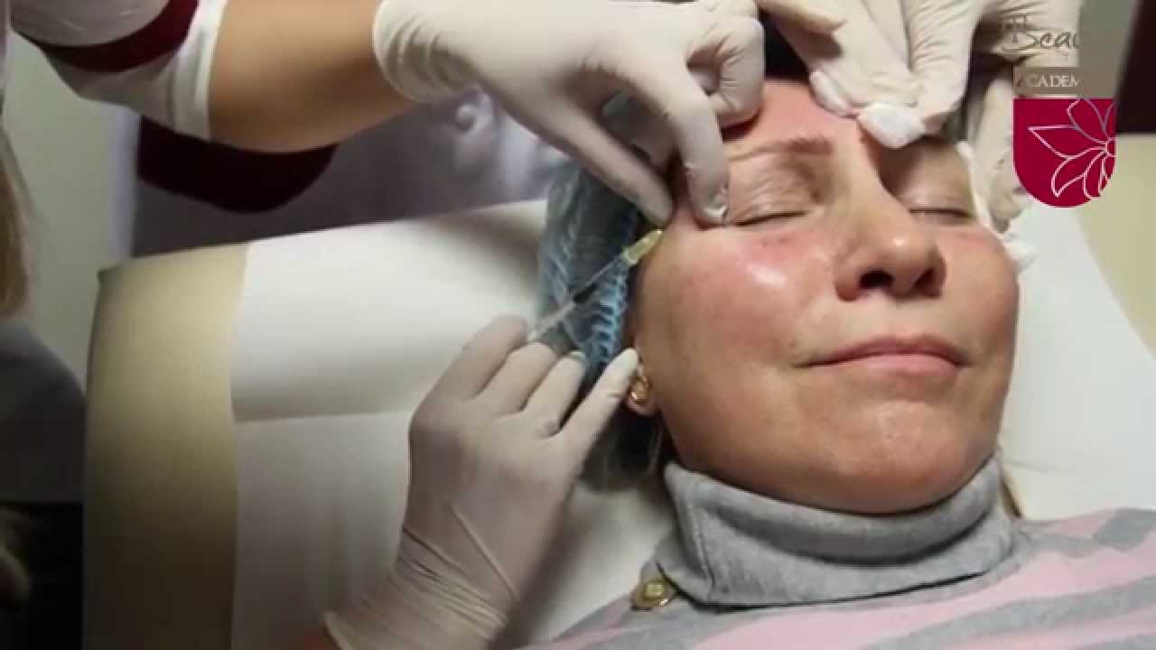 Dr. Amalia Anghel - Corecția cearcănelor cu acid hialuronic