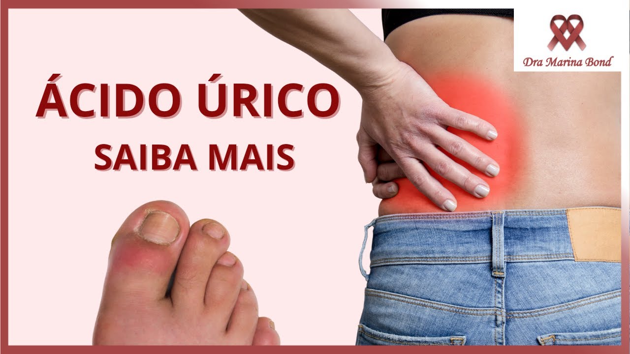 TUDO sobre ÁCIDO ÚRICO!