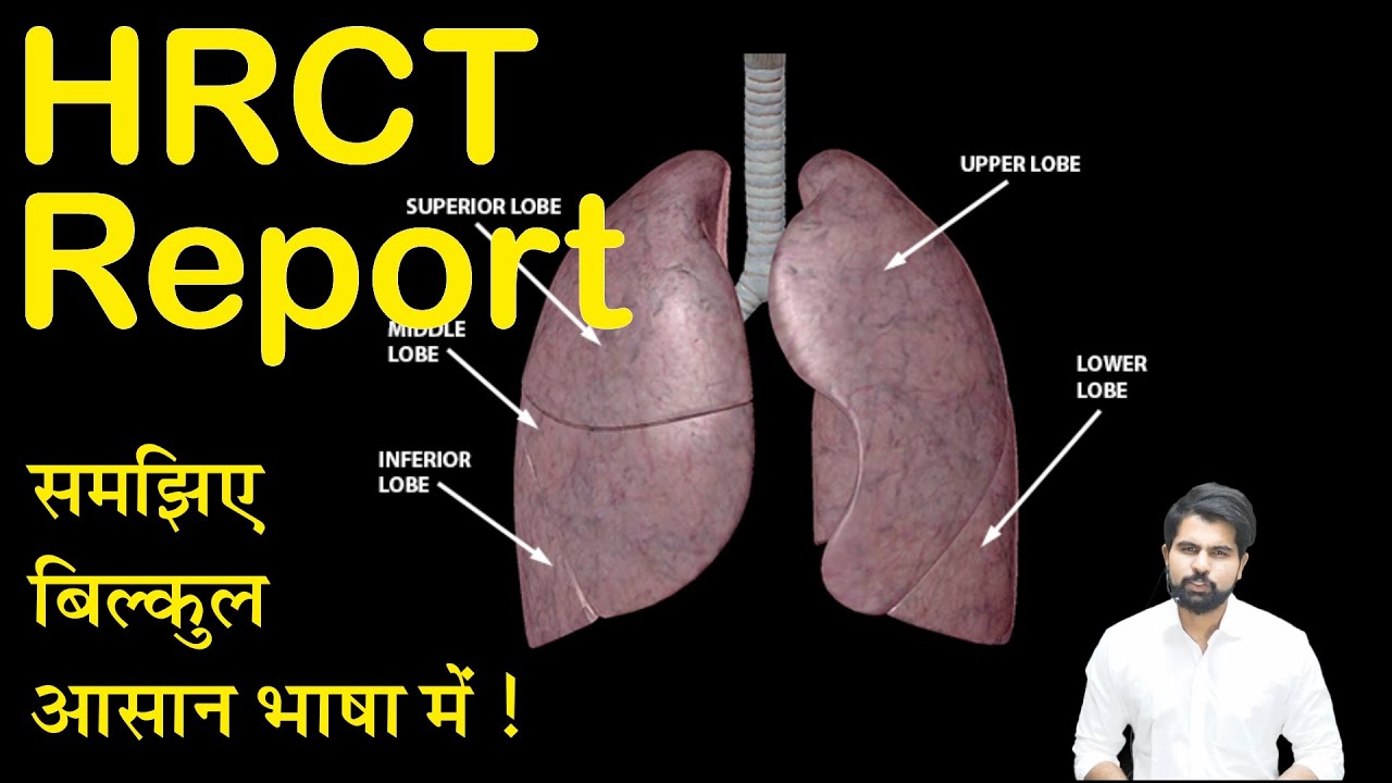 HRCT समझिए बिल्कुल आसान भाषा में | 25 में से कितना स्कोर खतरनाक होता है ! | #Corona  #covid-19