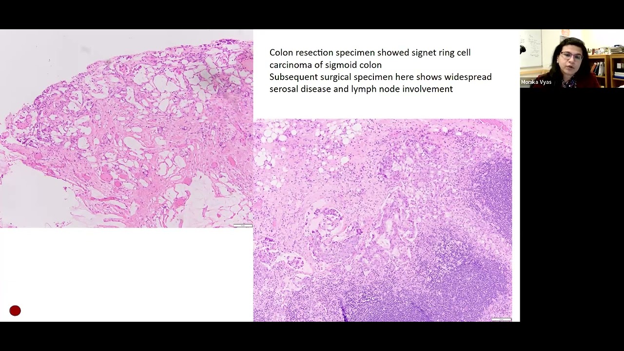 Pathoradiological corr cases (GI, pancreas) &ndash; Surgical Pathology and Cytology