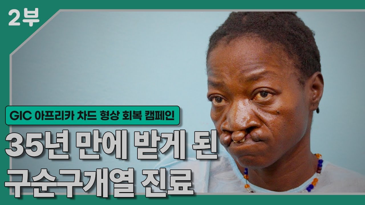 [GIC 후원 영상] 차드 의료봉사 형상회복 캠페인 - 아피야 (2부)