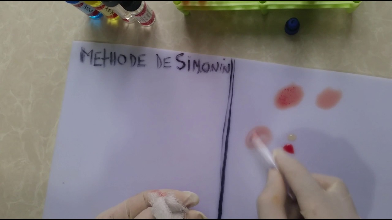 Groupage par methode de SIMONIN