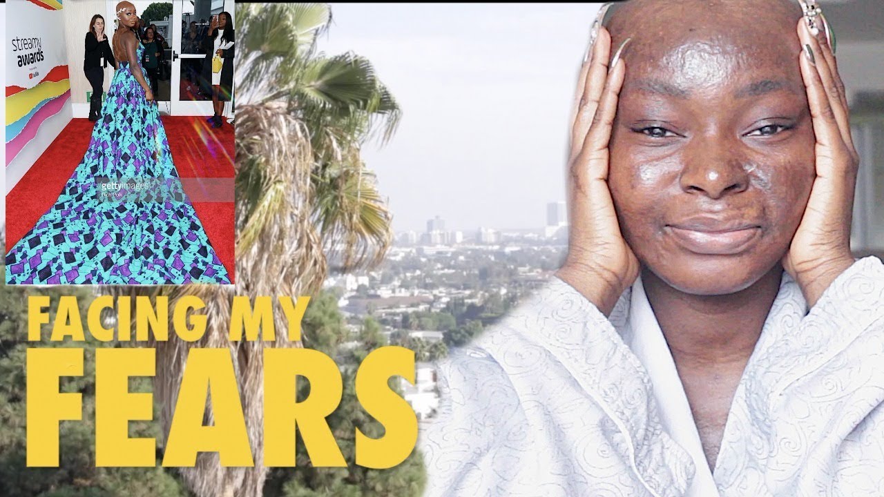 GOING OUT IN PUBLIC WITHOUT MY WIG FOR THE FIRST TIME IN 13YEARS! (FACING MY FEARS EP.2)