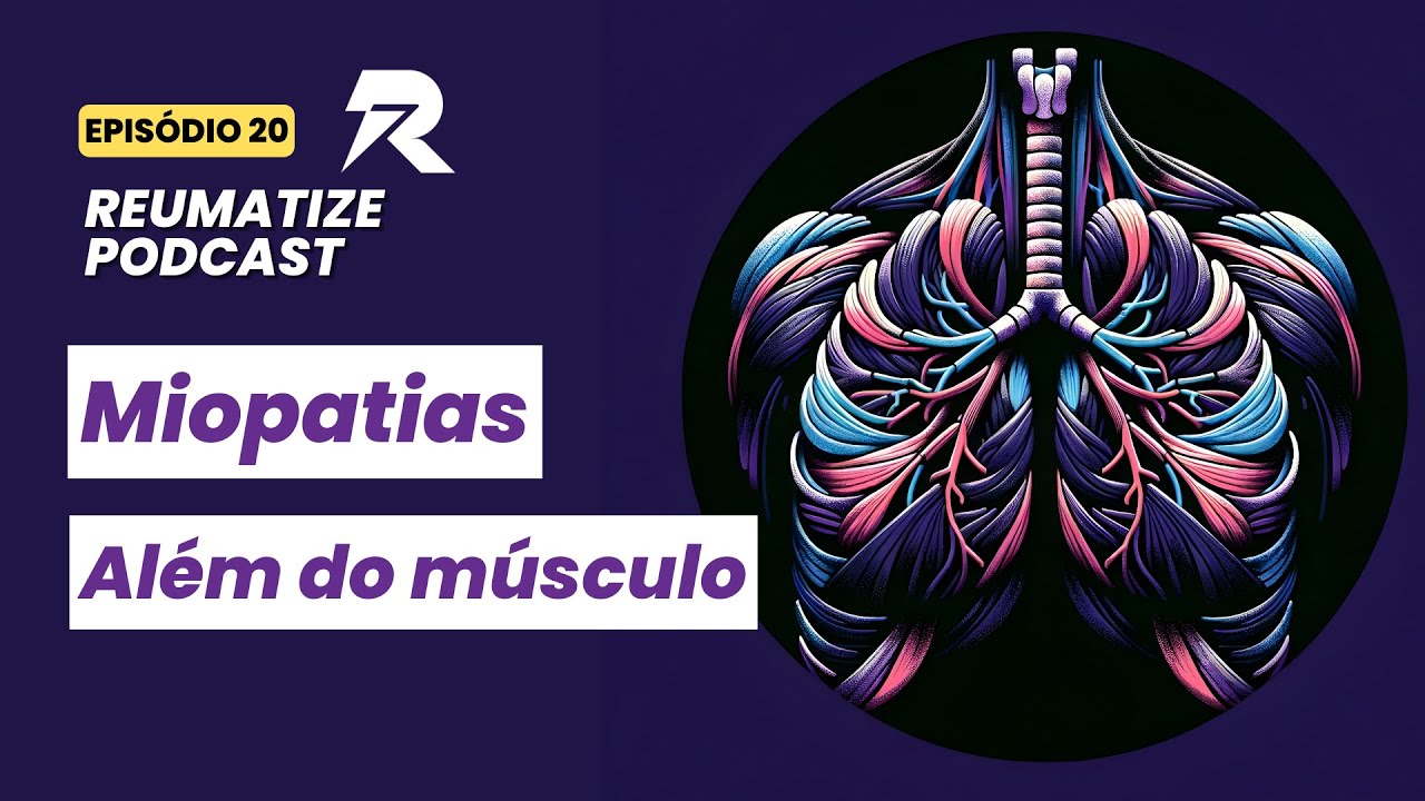 Miopatias - além do músculo | Reumatize | Episódio 20
