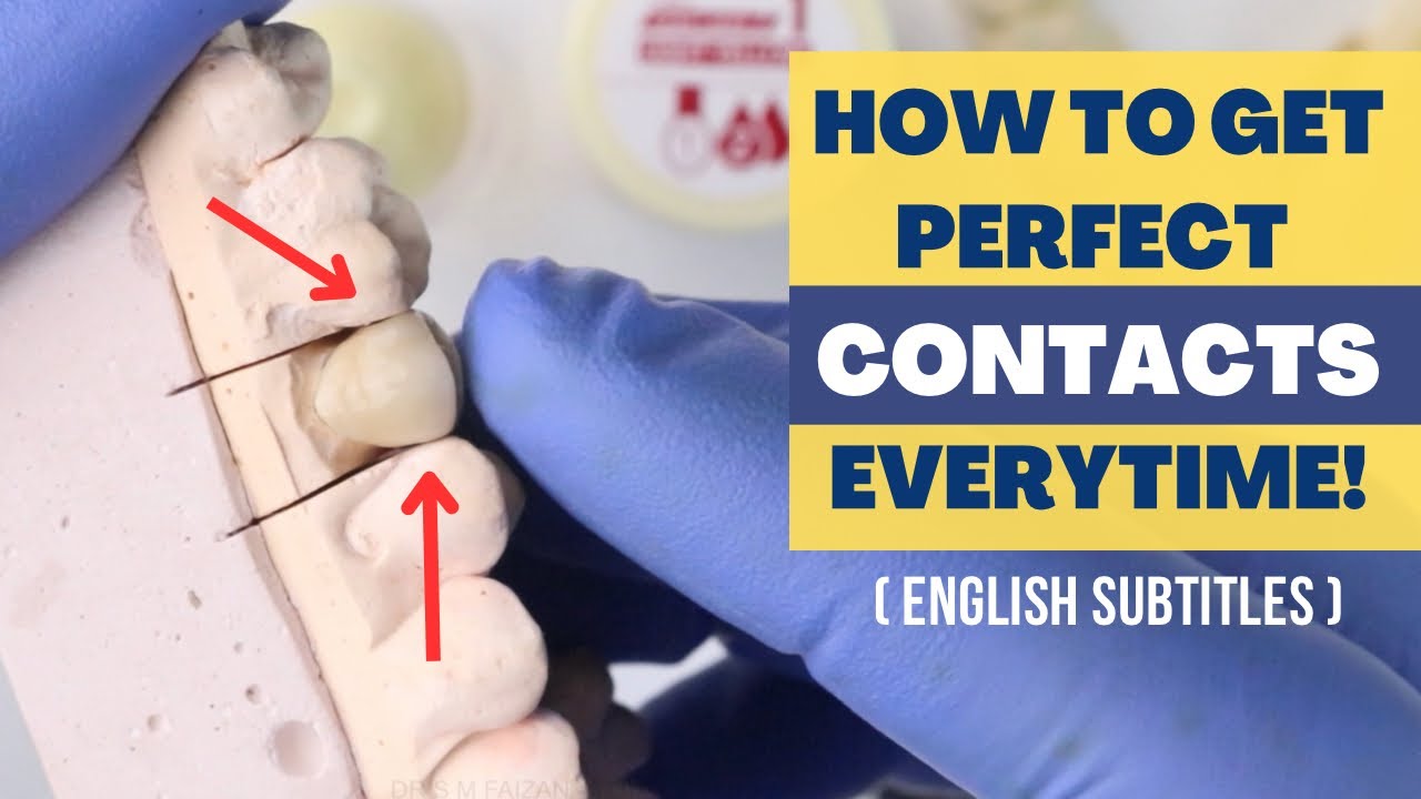 HOW TO GET PERFECT CONTACTS EVERYTIME!