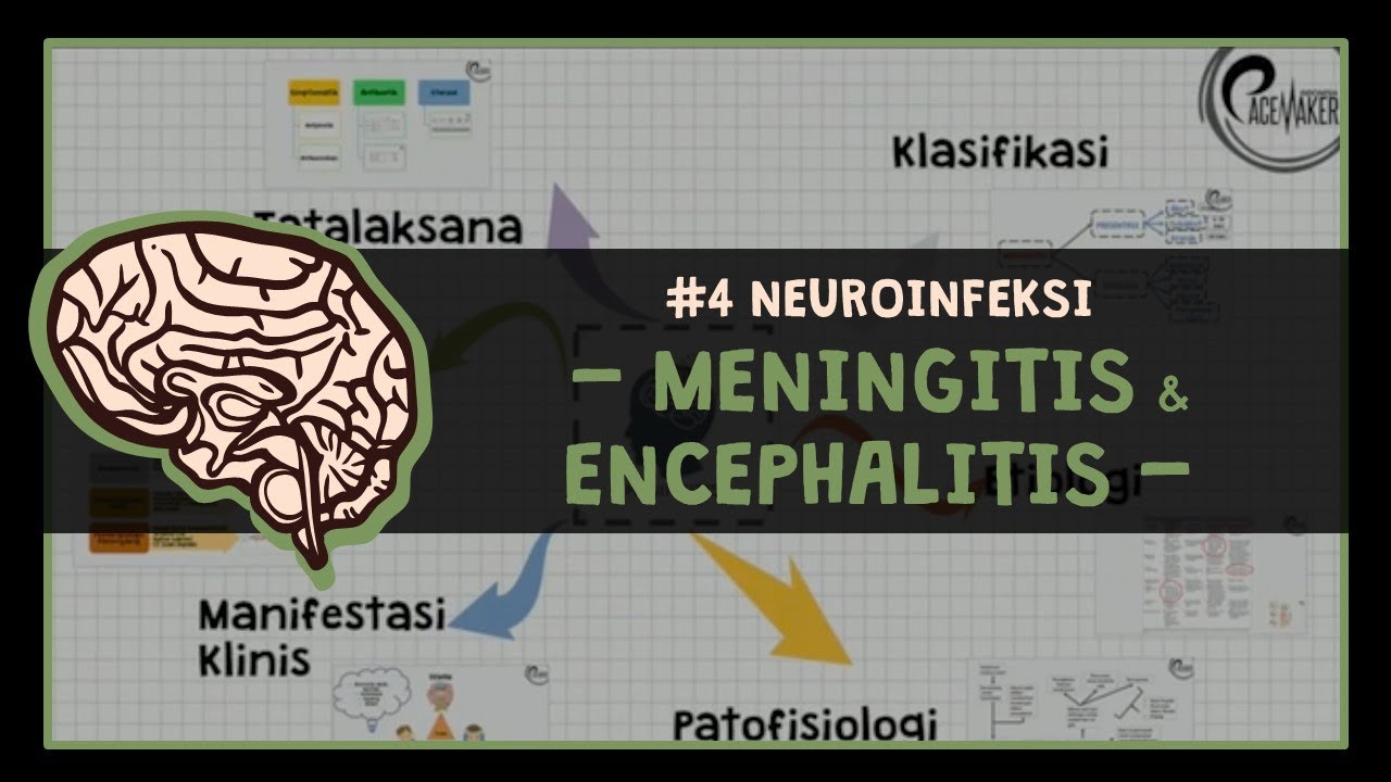 Meningitis & Encephalitis ; #4 NEUROINFECTIOUS DISEASE