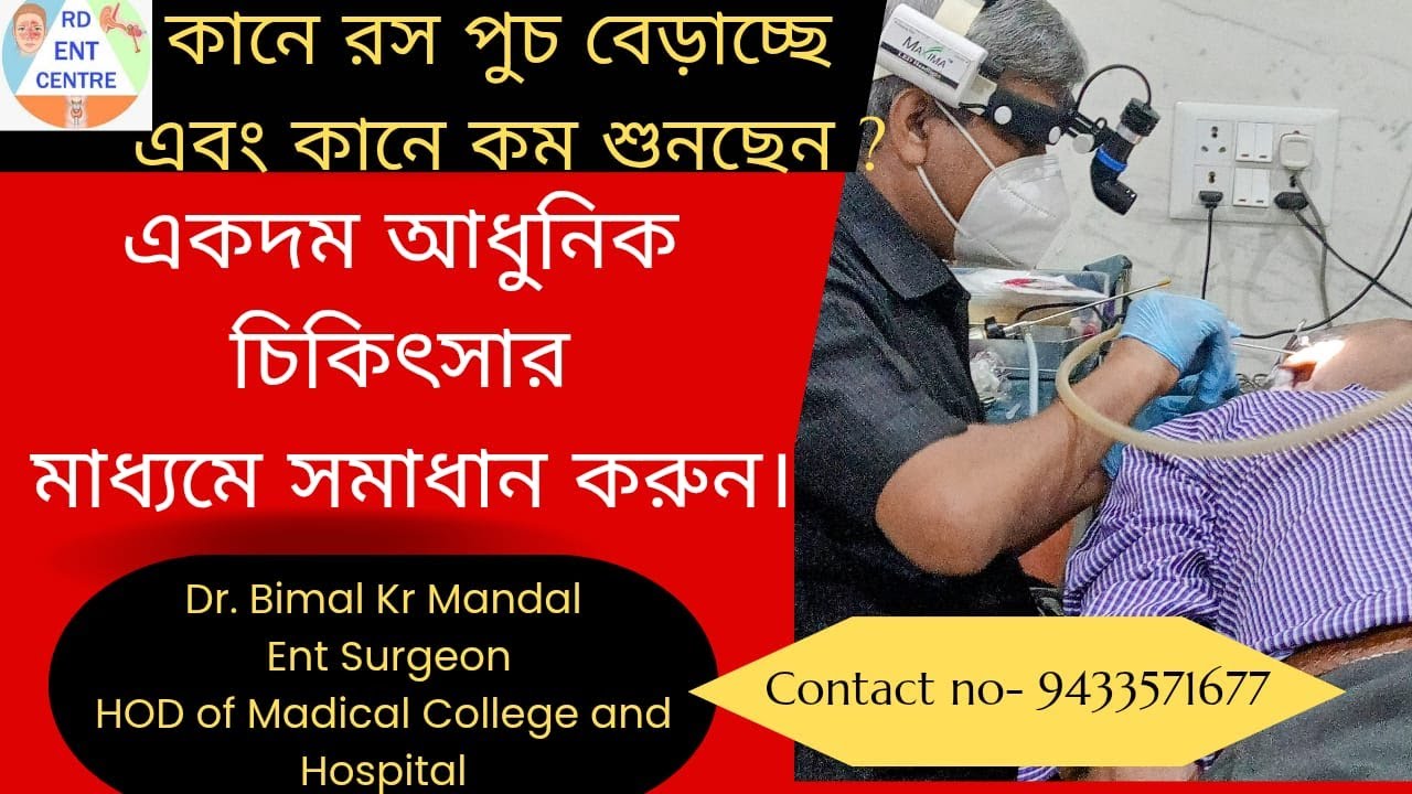 কানে রস পুচ  এবং কানে কম শুনছেন?একদম আধুনিক চিকিৎসার মাধ্যমে সমাধান করুন।✅Best tympanoplasty,✅