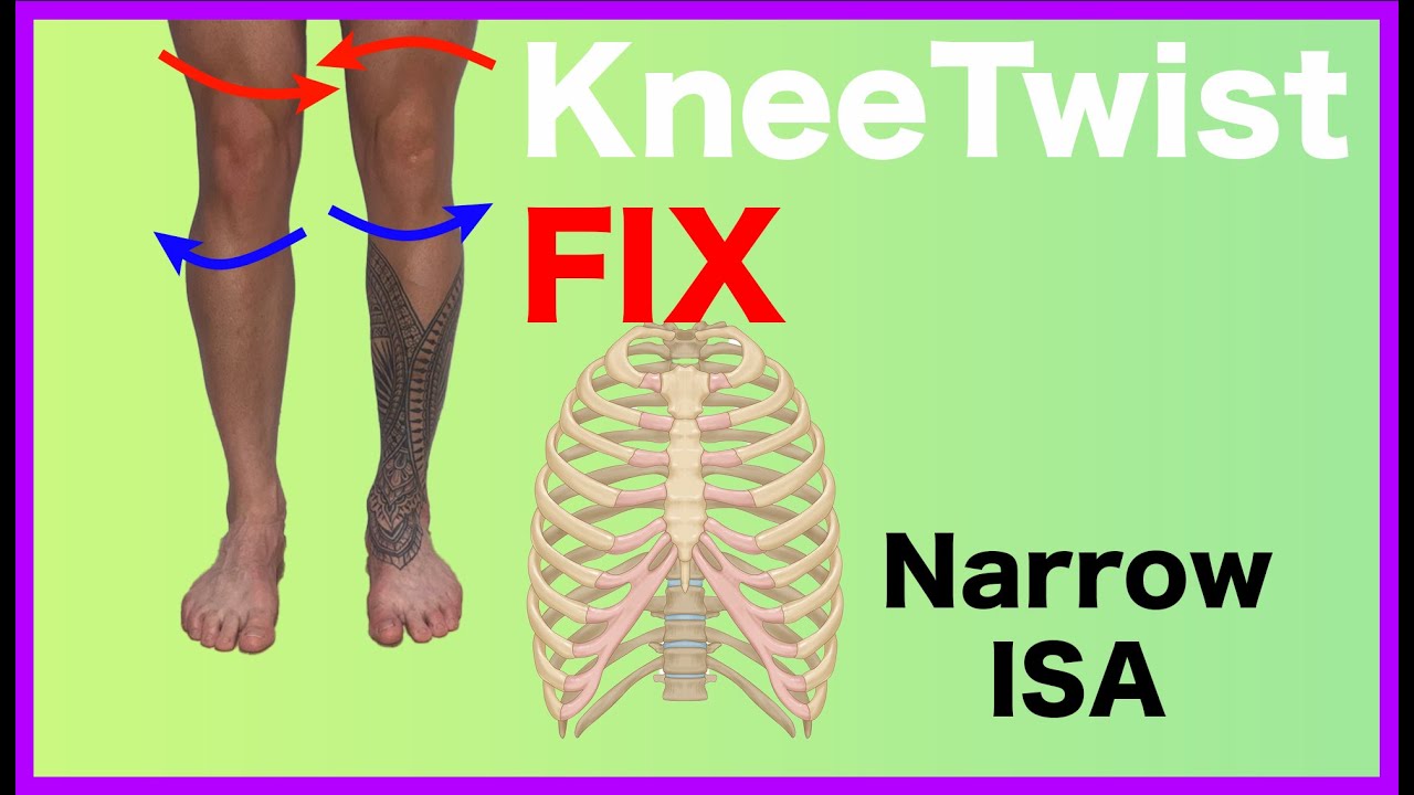 Have Knee Pain? Untwist It | Narrow Infrasternal Angle Case