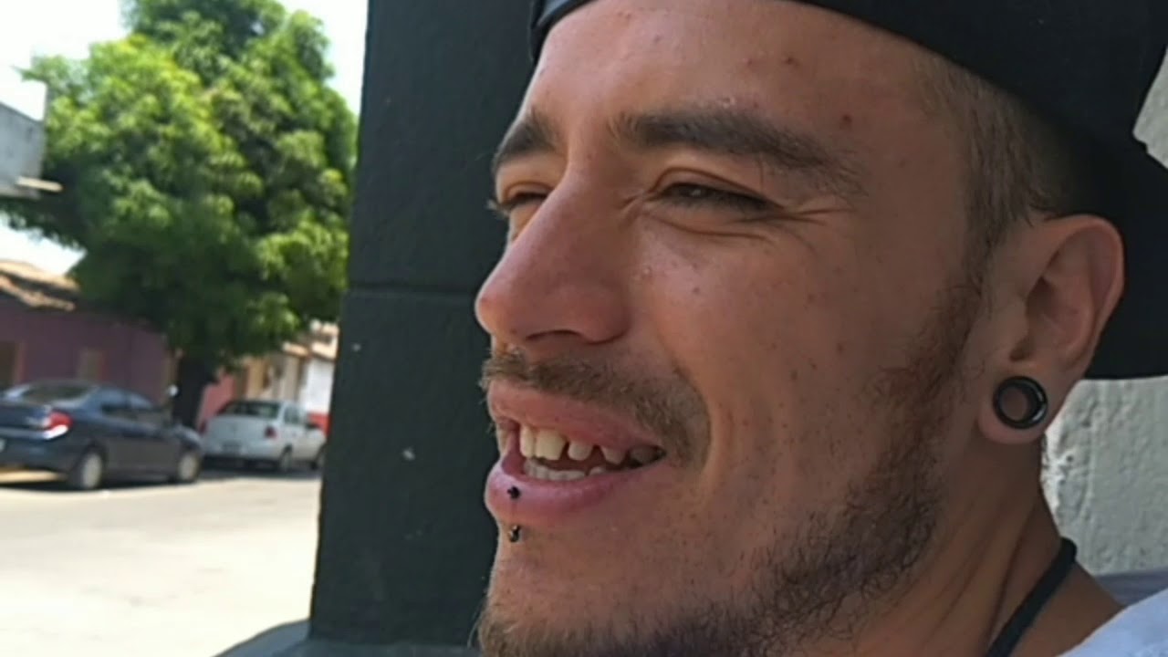 Bboy Cirujano