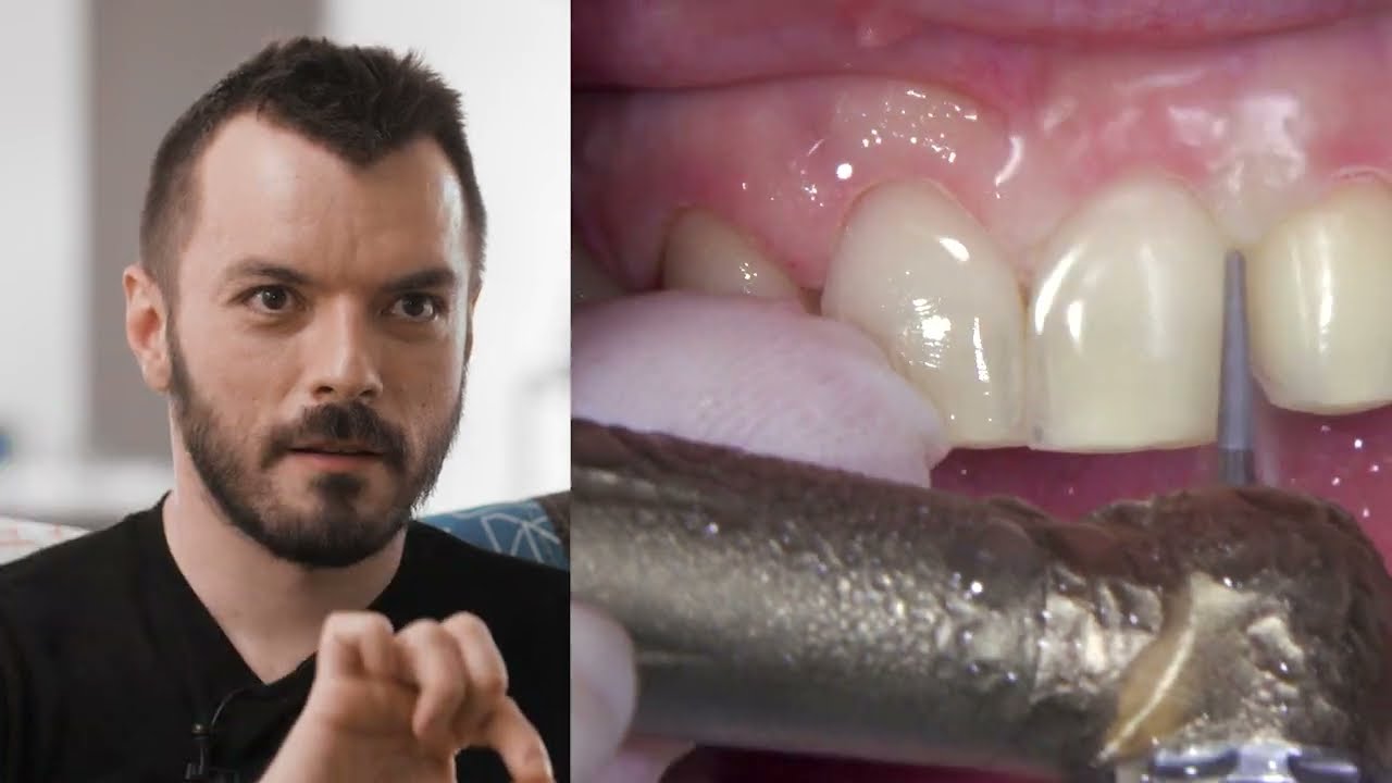 Dentcof Masterclass: RAW course