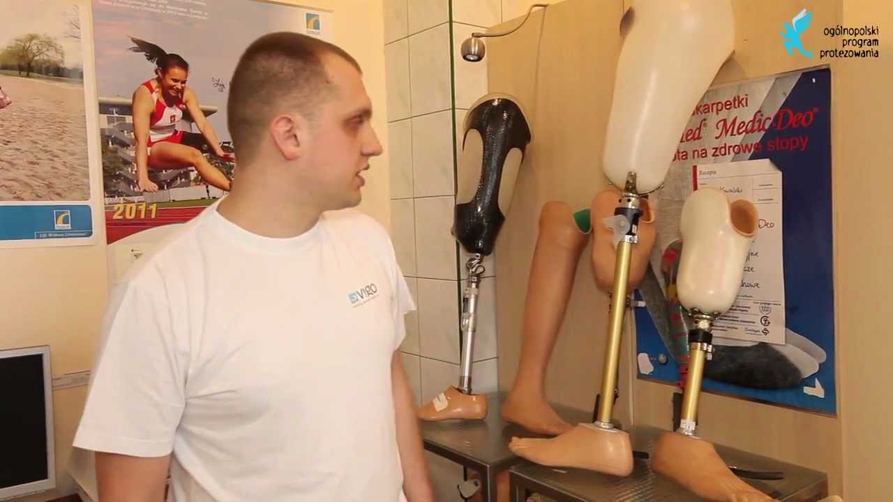 Co po amputacji?