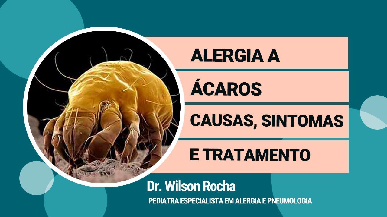 Alergia a &Aacute;caro - Causas, Sintomas e Tratamento | Dr. Wilson Rocha