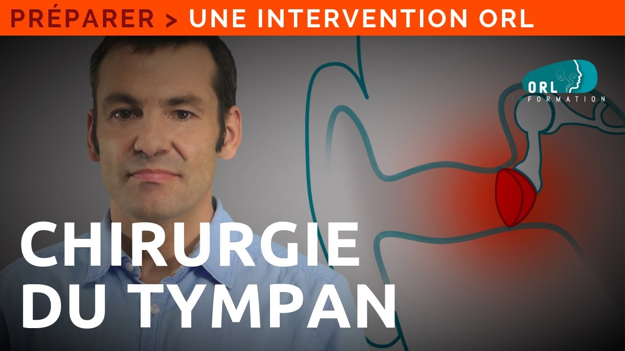 Information patient | Tympanoplastie - chirurgie de fermeture d'une perforation du tympan