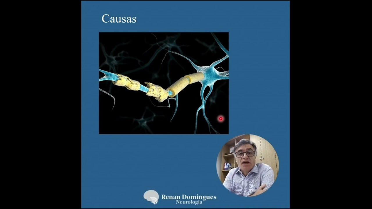 Mielite Transversa - causas, diagnóstico e tratamento