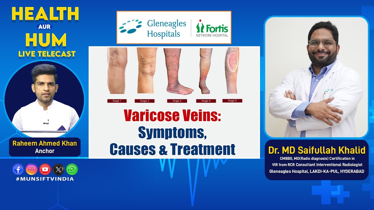 Varicose Veins: Symptoms, Causes & Treatment. Dr. MD Saifullah Khalid. Health Aur Hum | 07-02-2026 |