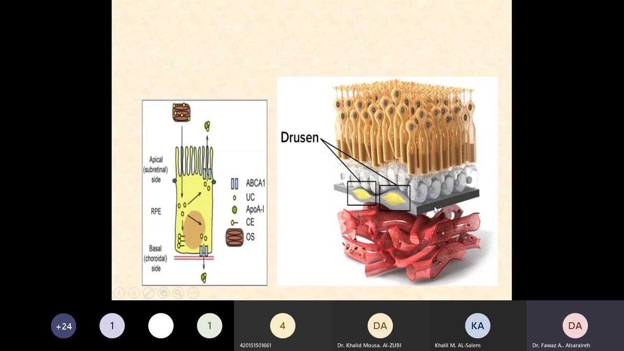 Retina   choroid ,  Dr. Fawaz Al Sarayreh
