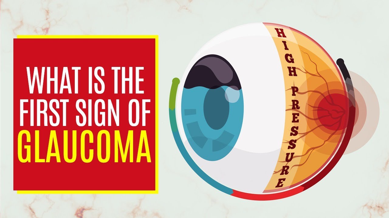 What is the First Sign of Glaucoma | Prevention Tips and Treatment
