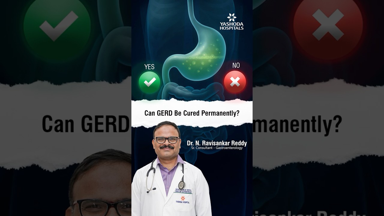 Can GERD Be Cured Permanently? - Dr. N. Ravisankar Reddy