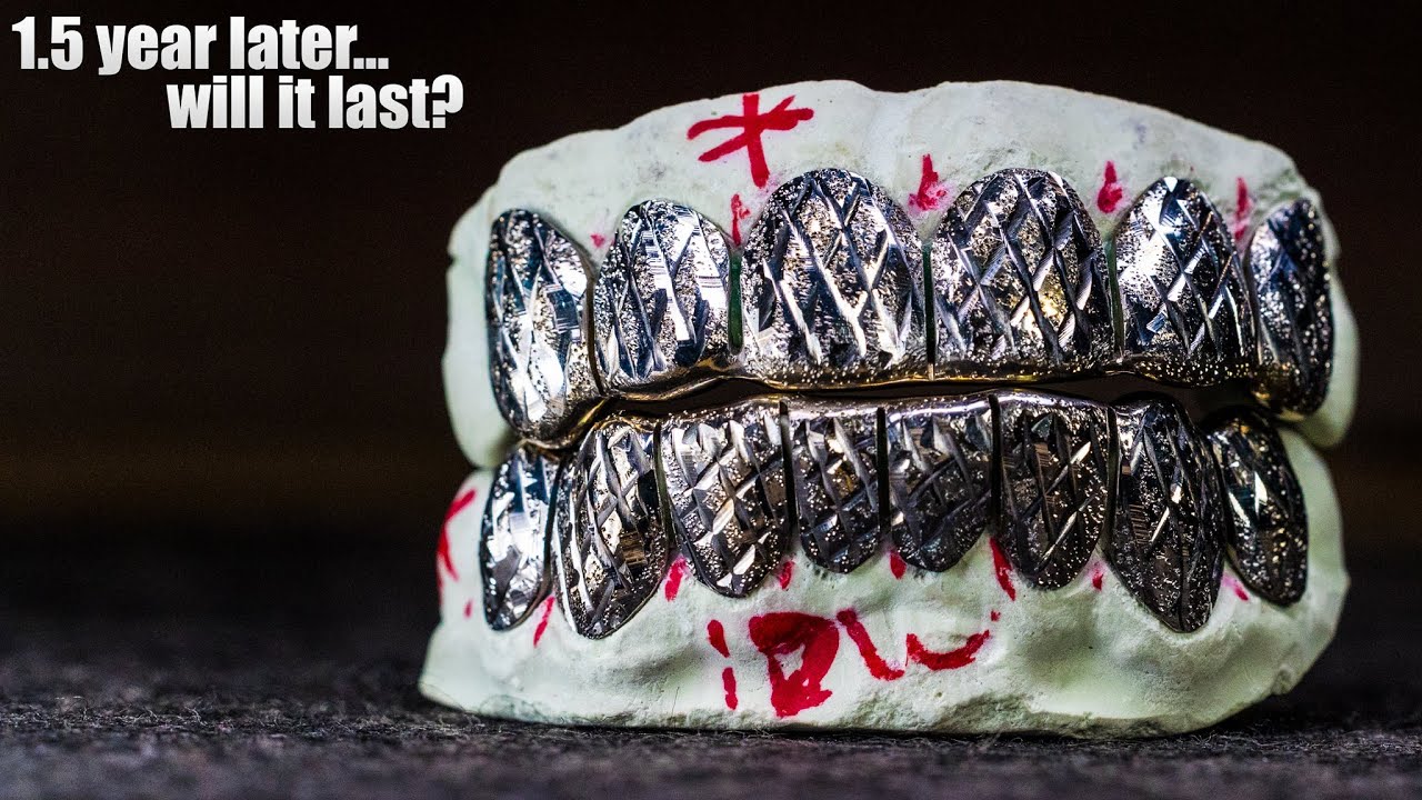 Обзор Custom Gold Grillz за 1 год
