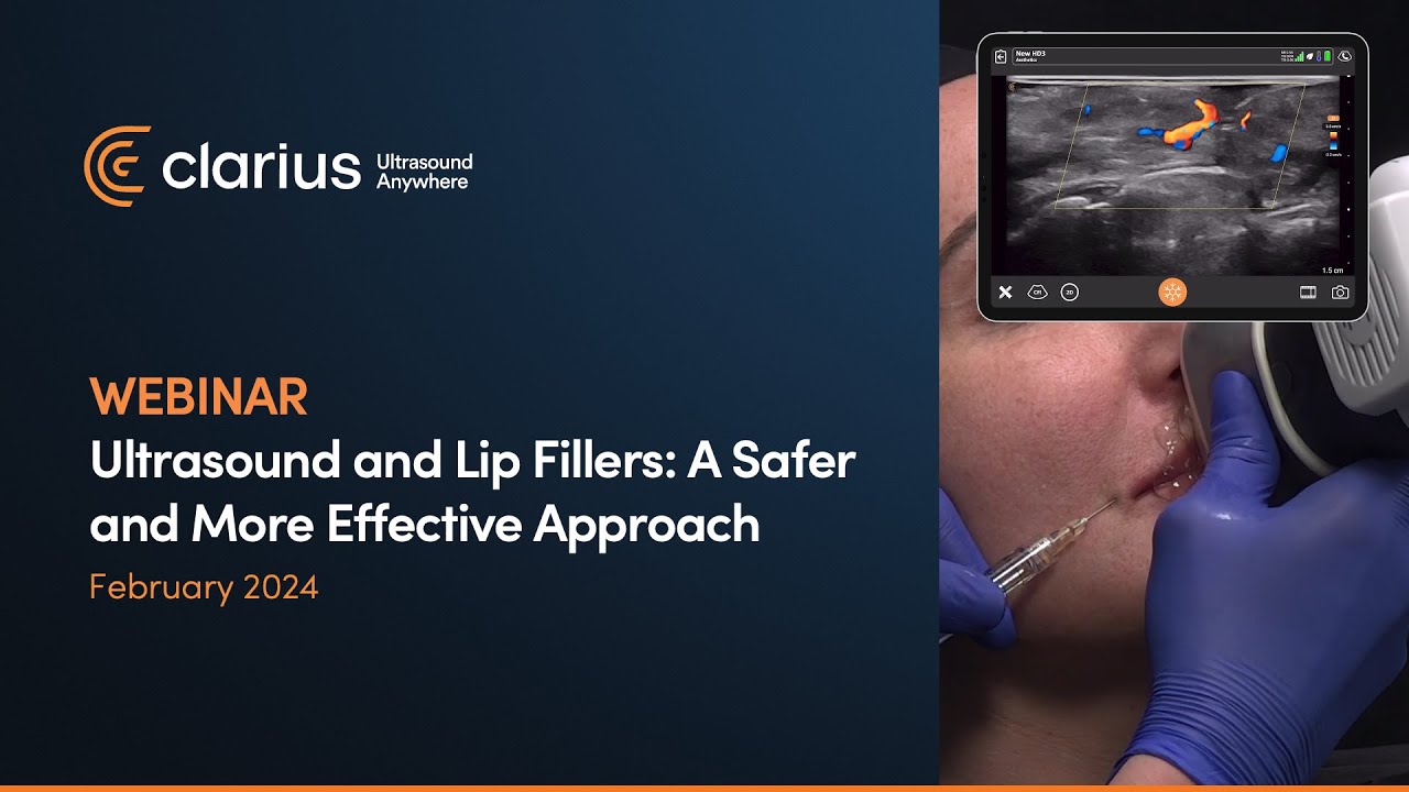 Ultrasound and Lip Fillers: A Safer and More Effective Approach