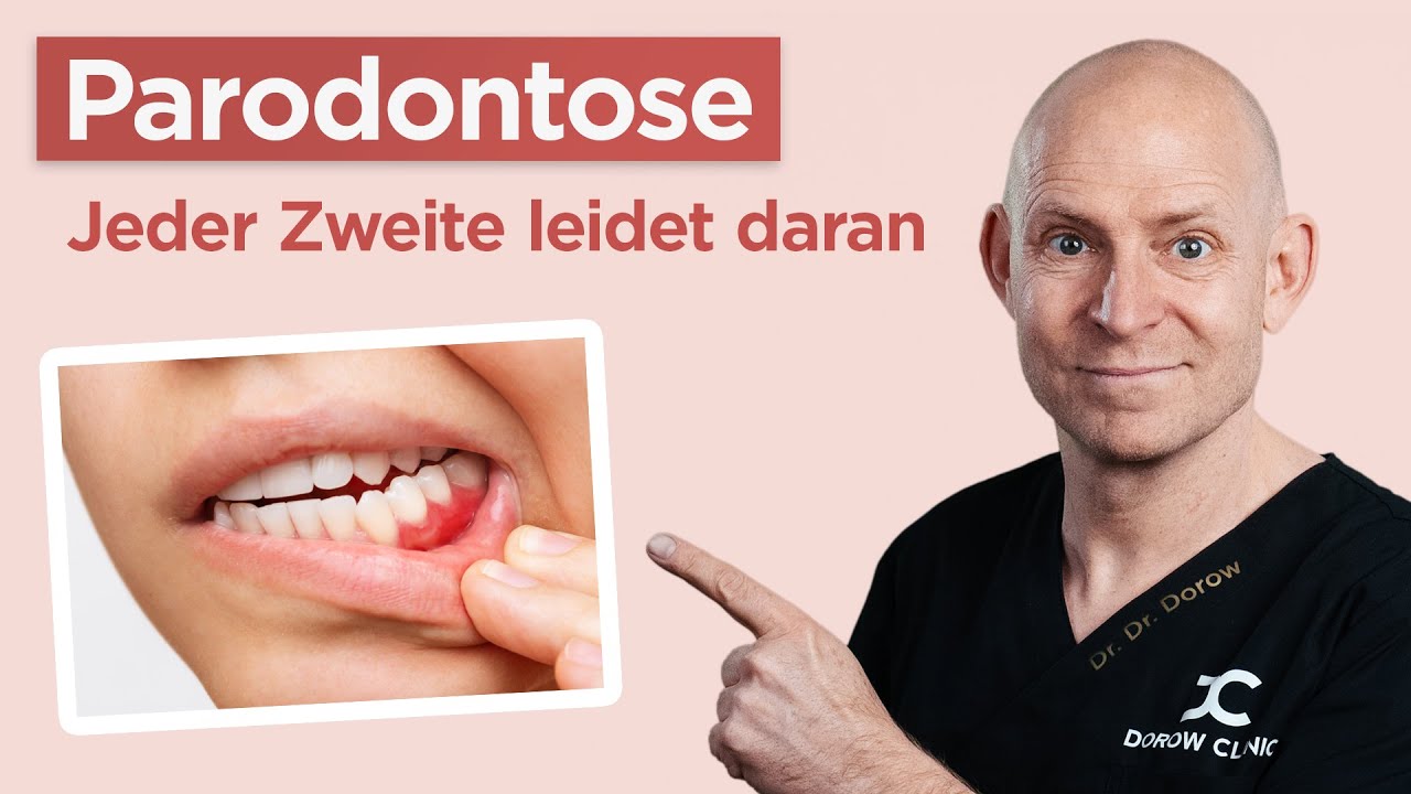 Die versteckte Bedrohung - Zahnfleischbluten