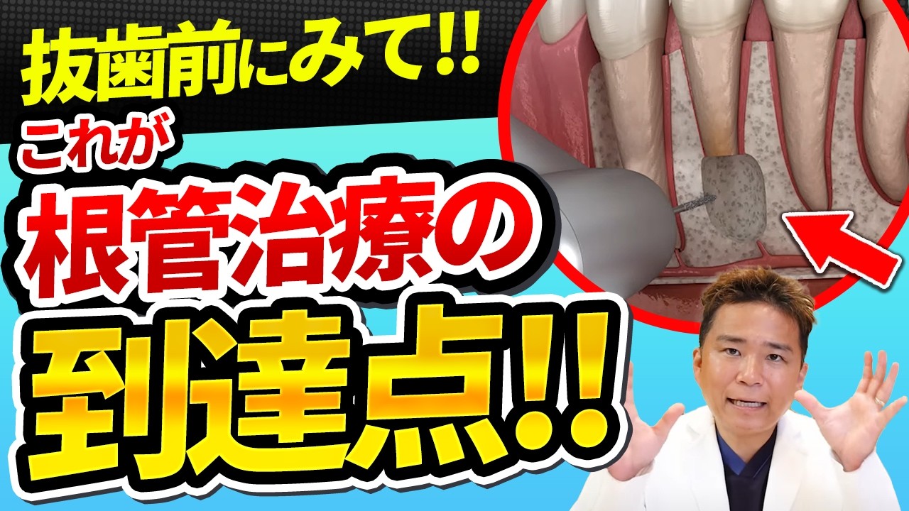 根管治療最後の砦！？保険でもOKな歯根端切除術とは
