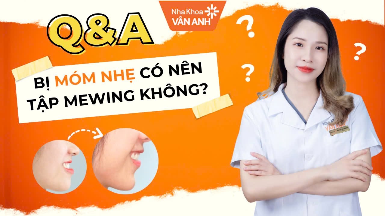 Móm nhẹ có nên tập Mewing không?