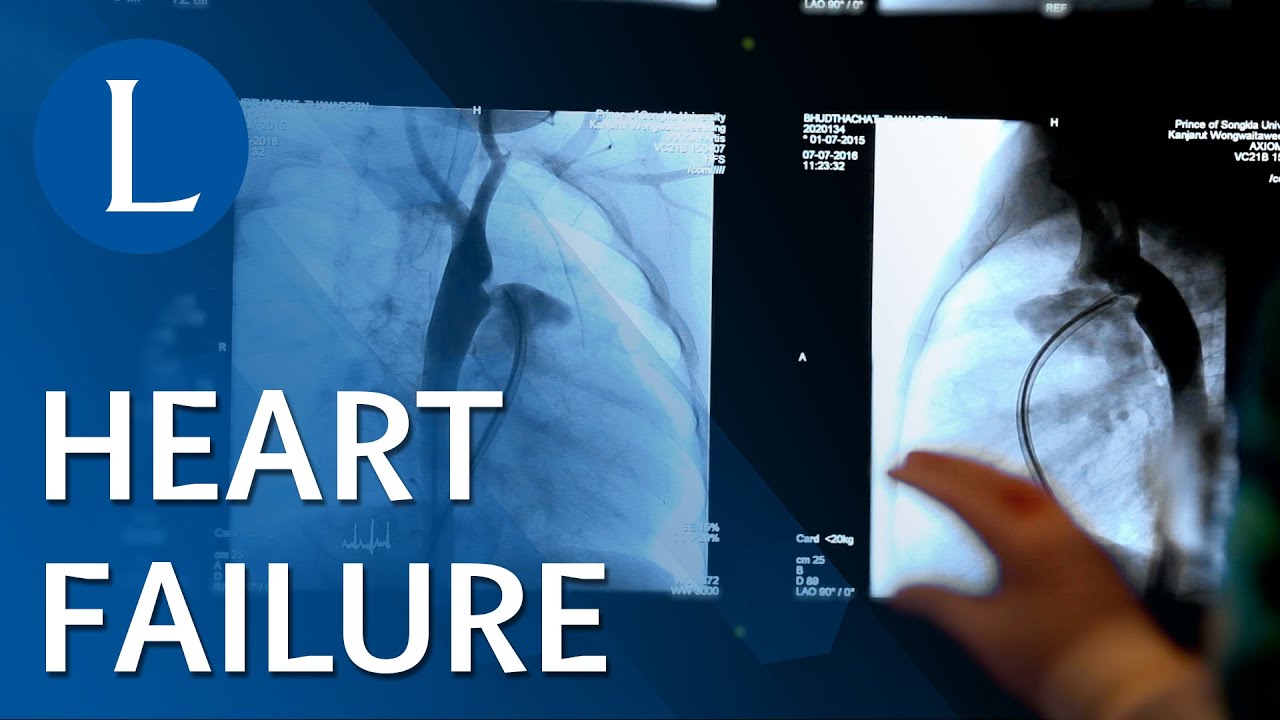 The Lancet Series on Heart Failure Prevention