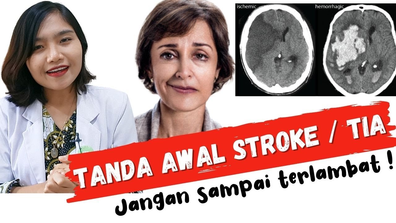 Gejala Awal Sakit Stroke TIA , Kenali sebelum Terlambat ! | dr. Ema Surya P