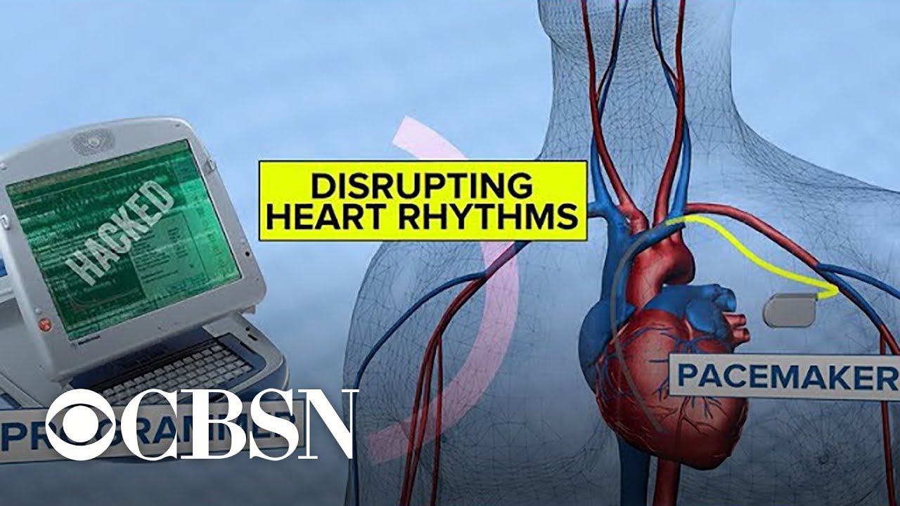 FDA looks into the risk of medical devices being hacked