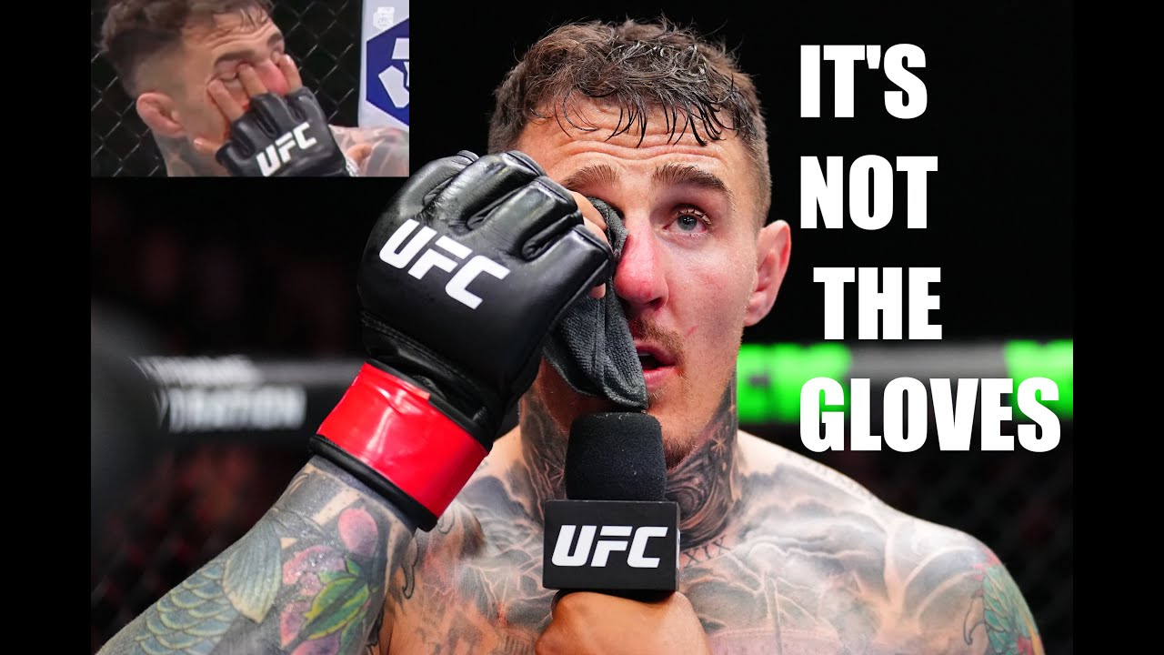 Дело не в перчатках