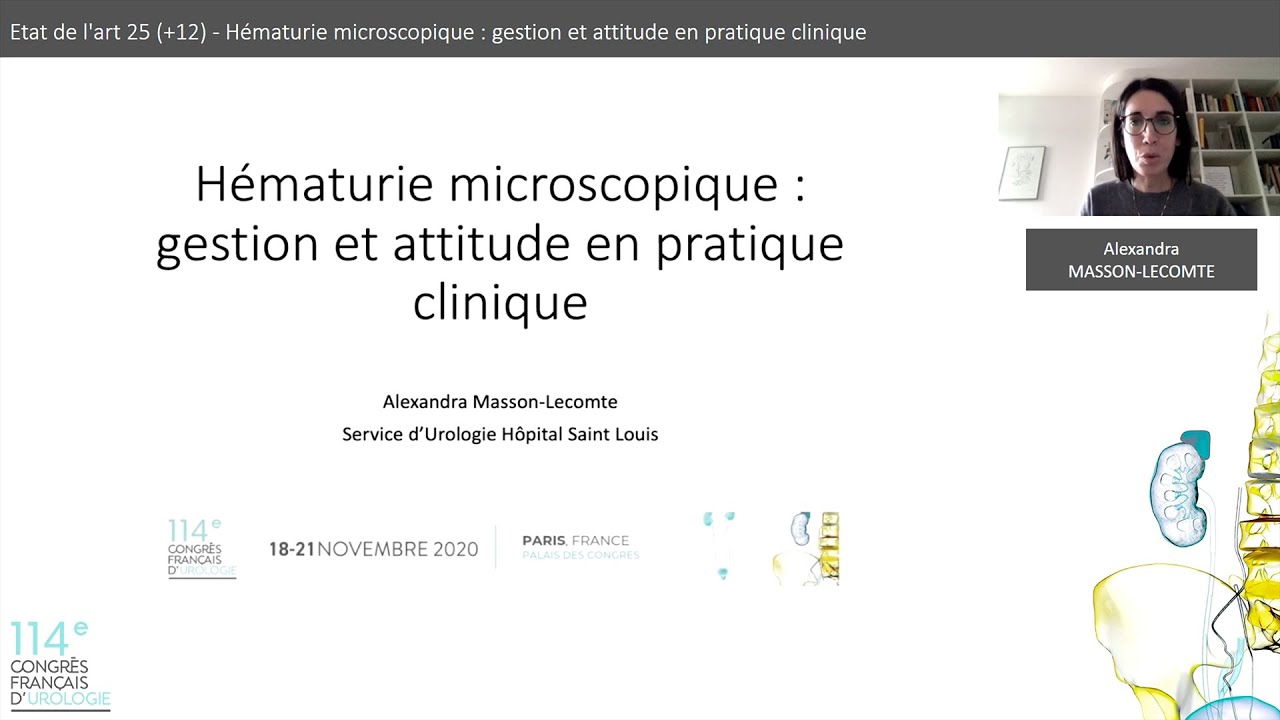 Hématurie microscopique : gestion et attitude en pratique clinique