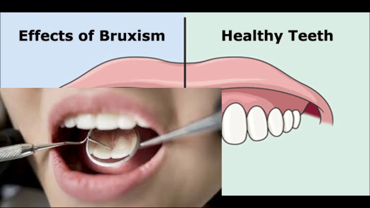 Teeth Whitening Laser Costa Mesa, California