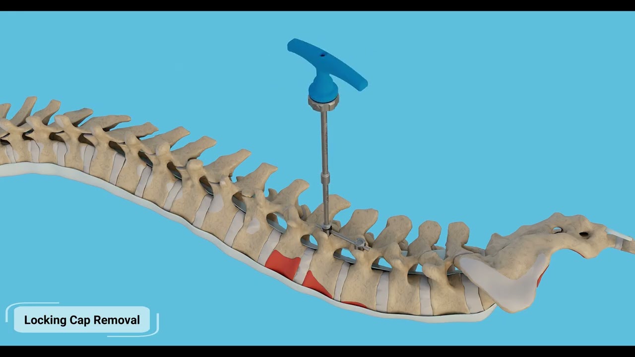 SHUKLA Spine Animated System Overview
