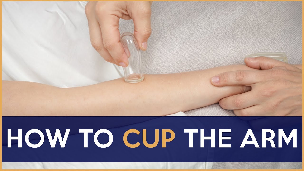 How to Cup the Arm - Myofascial Cupping on the Wrist and Forearm