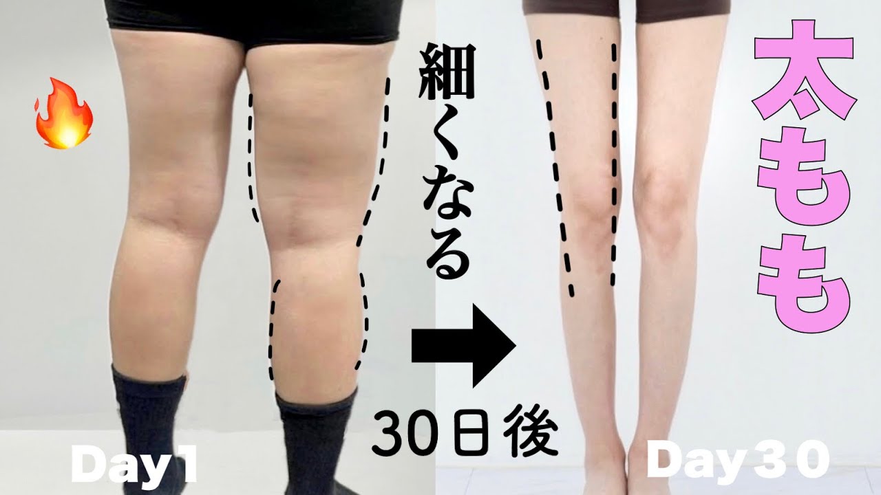 【寝たまま】超短期ダイエット！見た目も体重も痩せるカエル足トレーニング！【夏までに痩せる🔥】