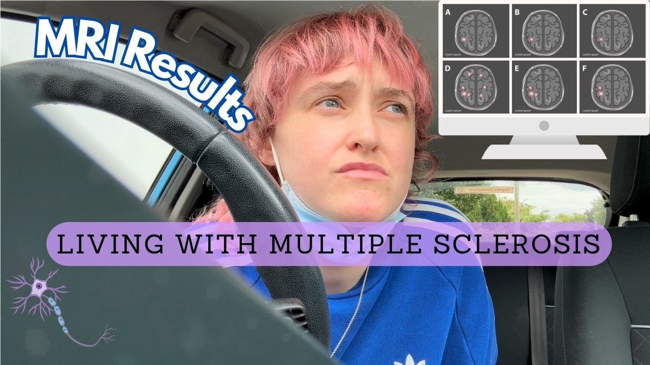 I got my MRI results | another day, another lesion 🙁discussing my results and plans going forward.