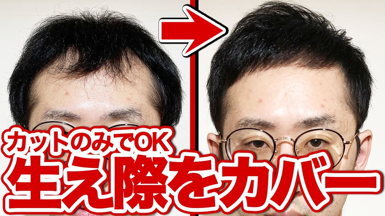 【生え際の薄毛】ワックスを使わずにカバーできるカット術!!