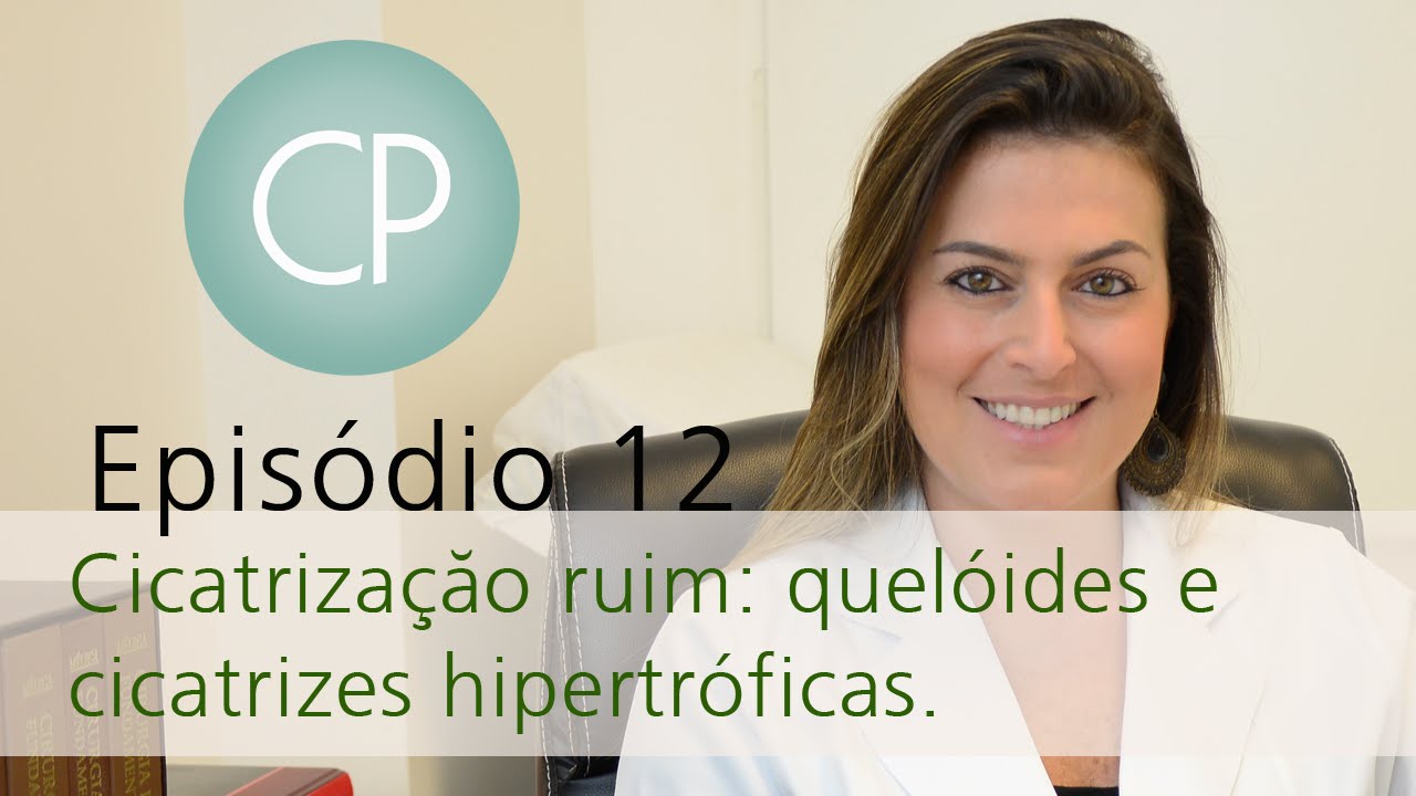 Cirurgia Plástica - Cicatrização ruim: quelóides e cicatrizes hipertróficas.