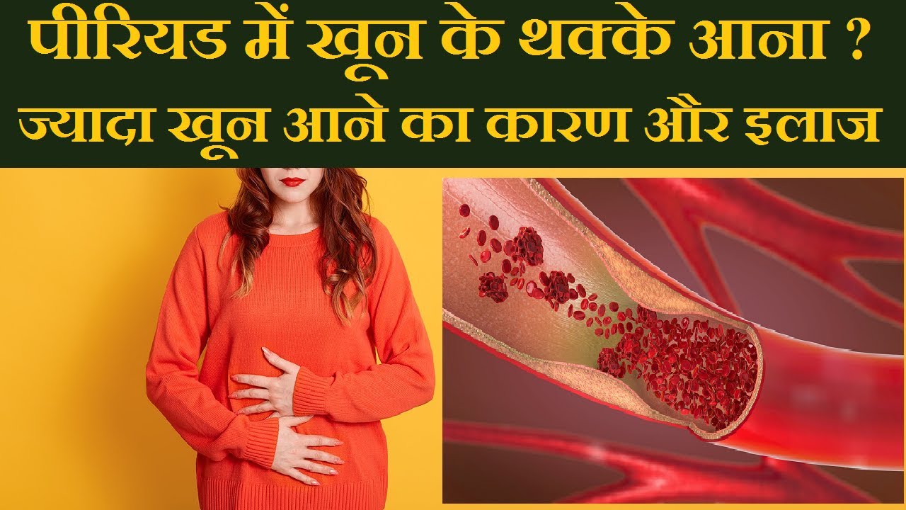 पीरियड्स में खून के थक्के या ज्यादा खून आने को कैसे रोके? Heavy Period