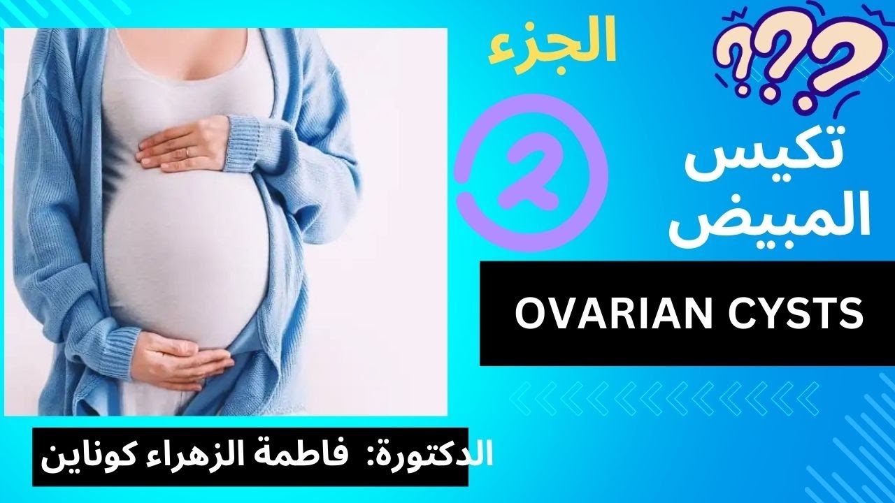 تكيس المبيض 2